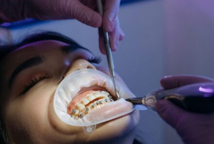 Root canal treatment: A comprehensive guide