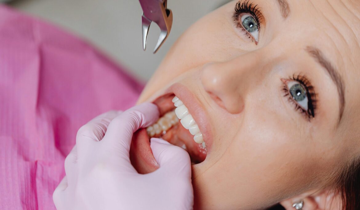 Wisdom Tooth Extraction: Everything You Need To Know By Universal Smiles Dental