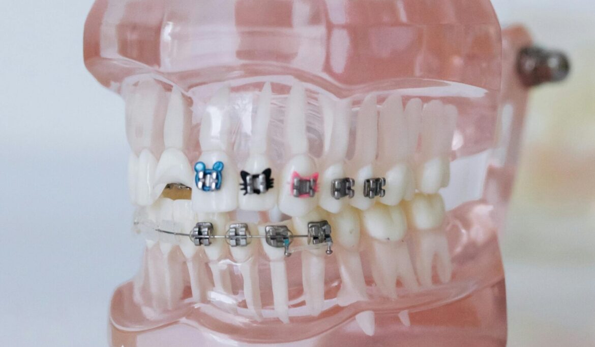 Braces Mistakes to Avoid: What Every Patient Should Know
