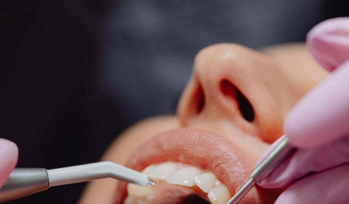 First Aid for Common Dental Emergencies: What You Need to Know