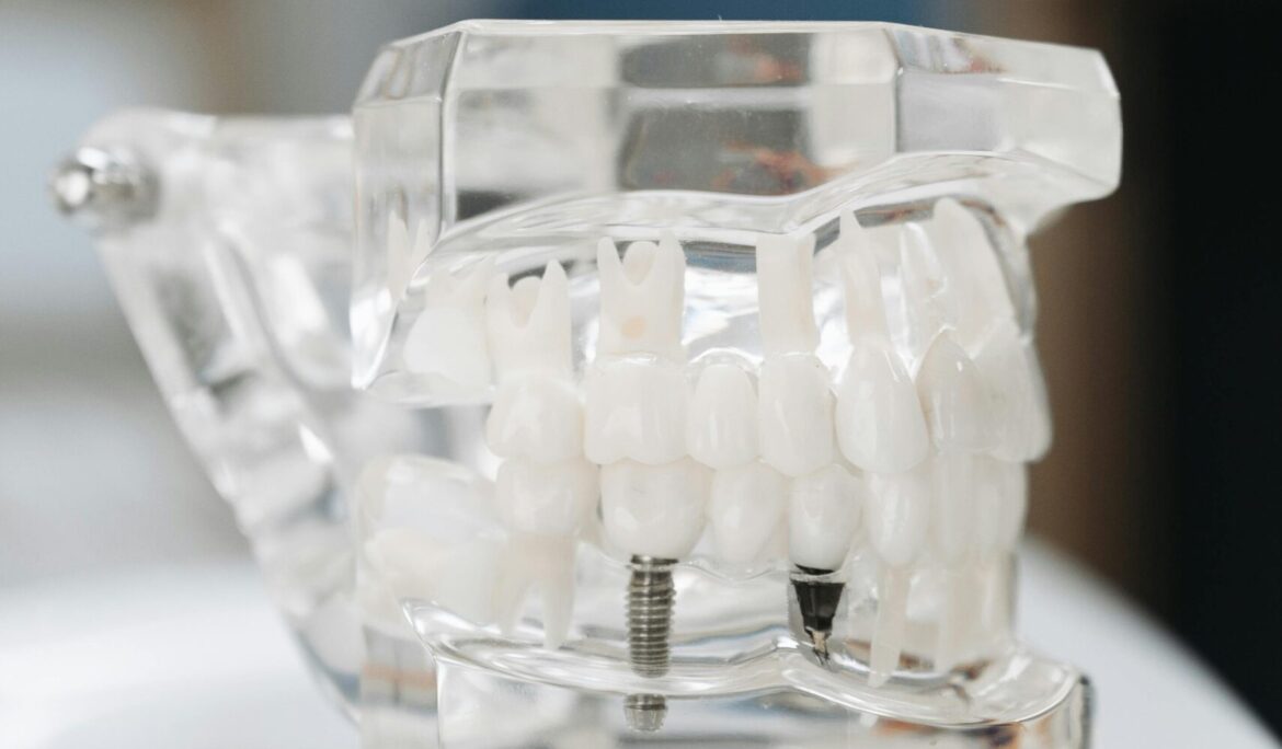 Dental Implants for Elderly: A Transformative Smile Solution
