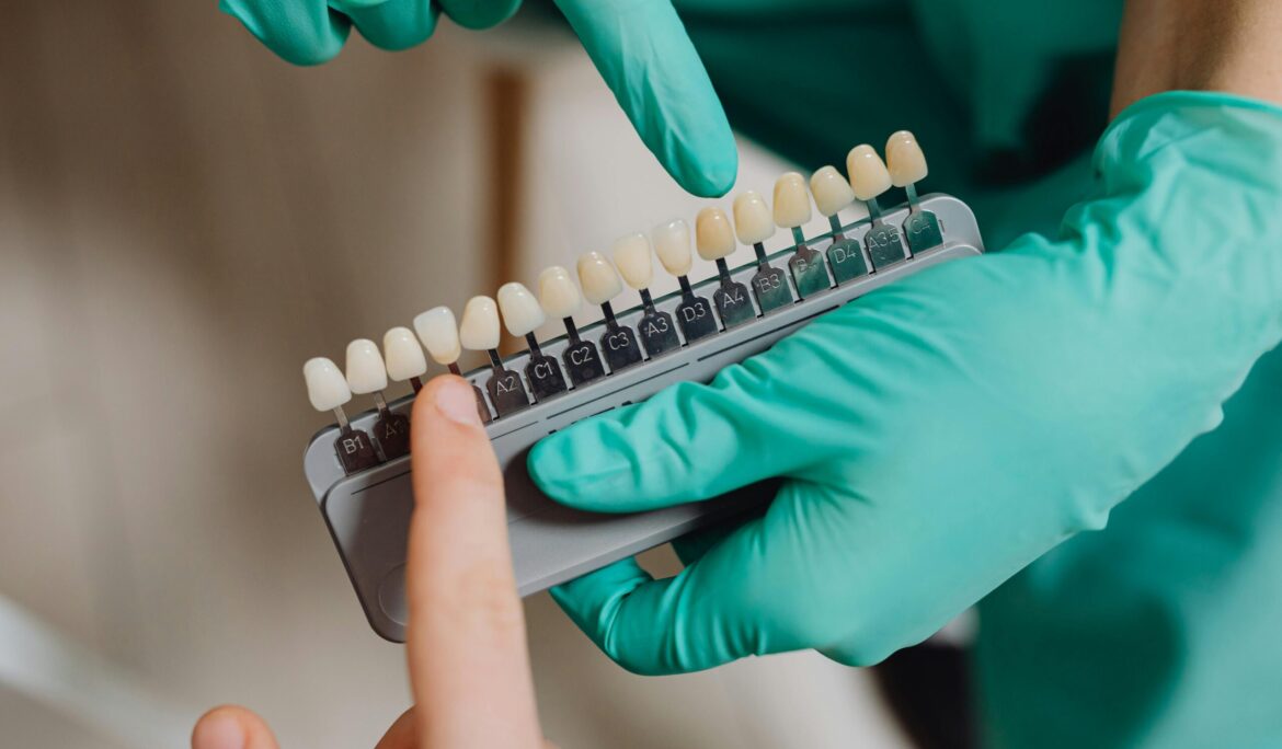 Benefits of Dental Crowns: An In-Depth Guide by Universal Smiles Dental