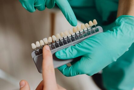 Benefits of Dental Crowns: An In-Depth Guide by Universal Smiles Dental