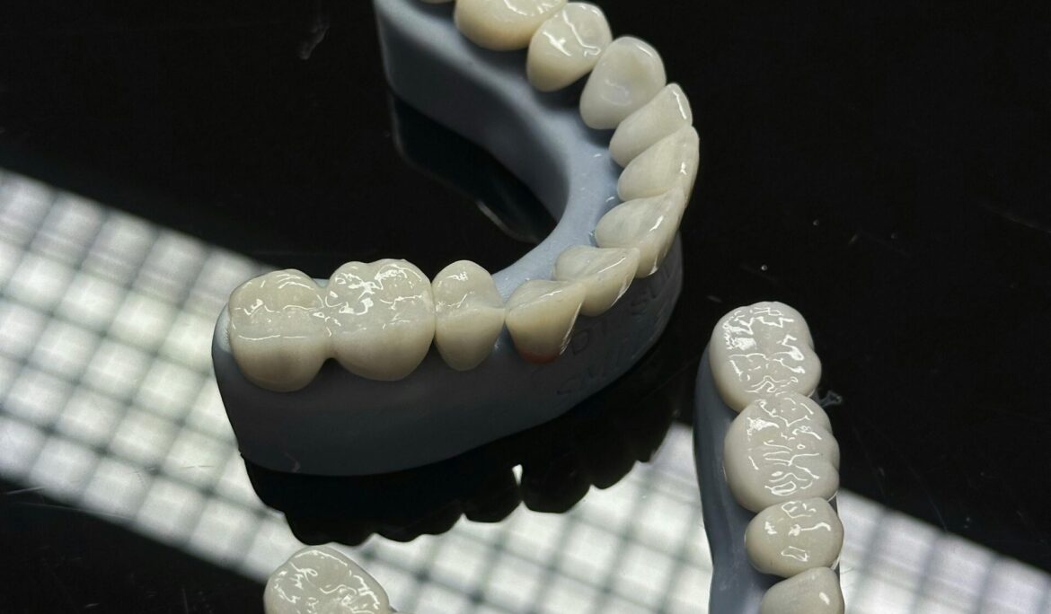 The Benefits of Restorative Dentistry at Universal Smiles Dental