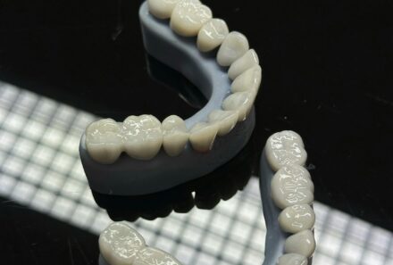 The Benefits of Restorative Dentistry at Universal Smiles Dental