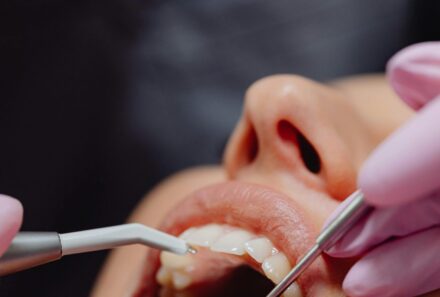 A Friendly Family Guide on the Role of Dental Check-ups