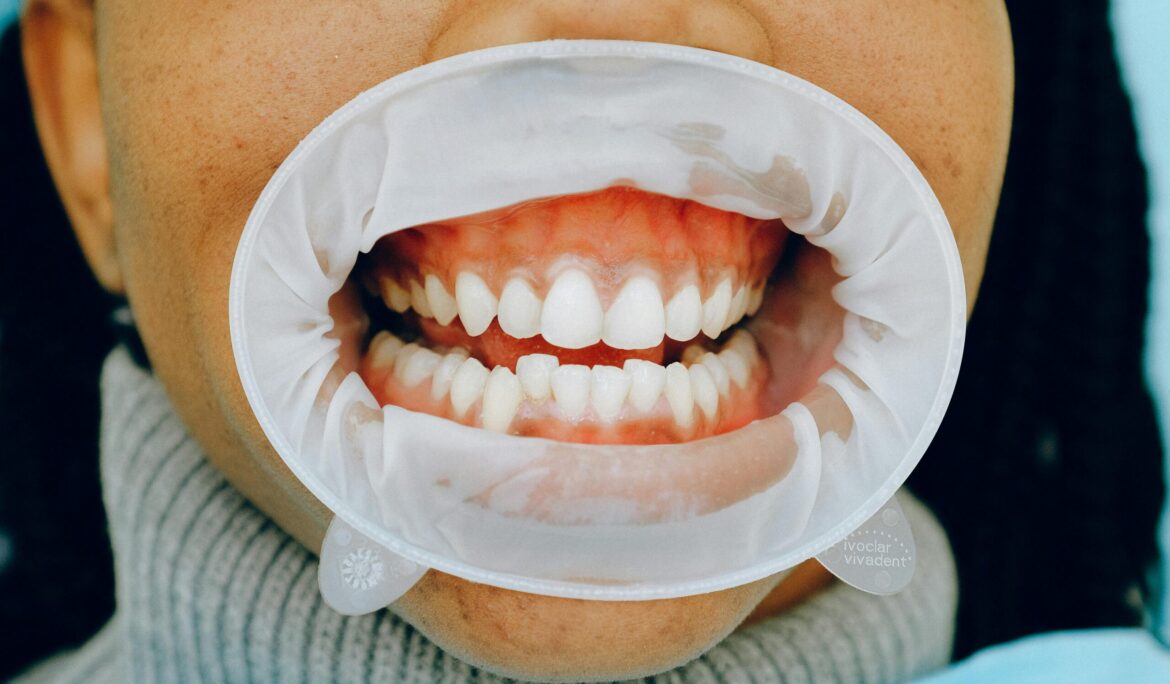 Relationship between Diet and Oral Health: What You Eat Affects Your Smile