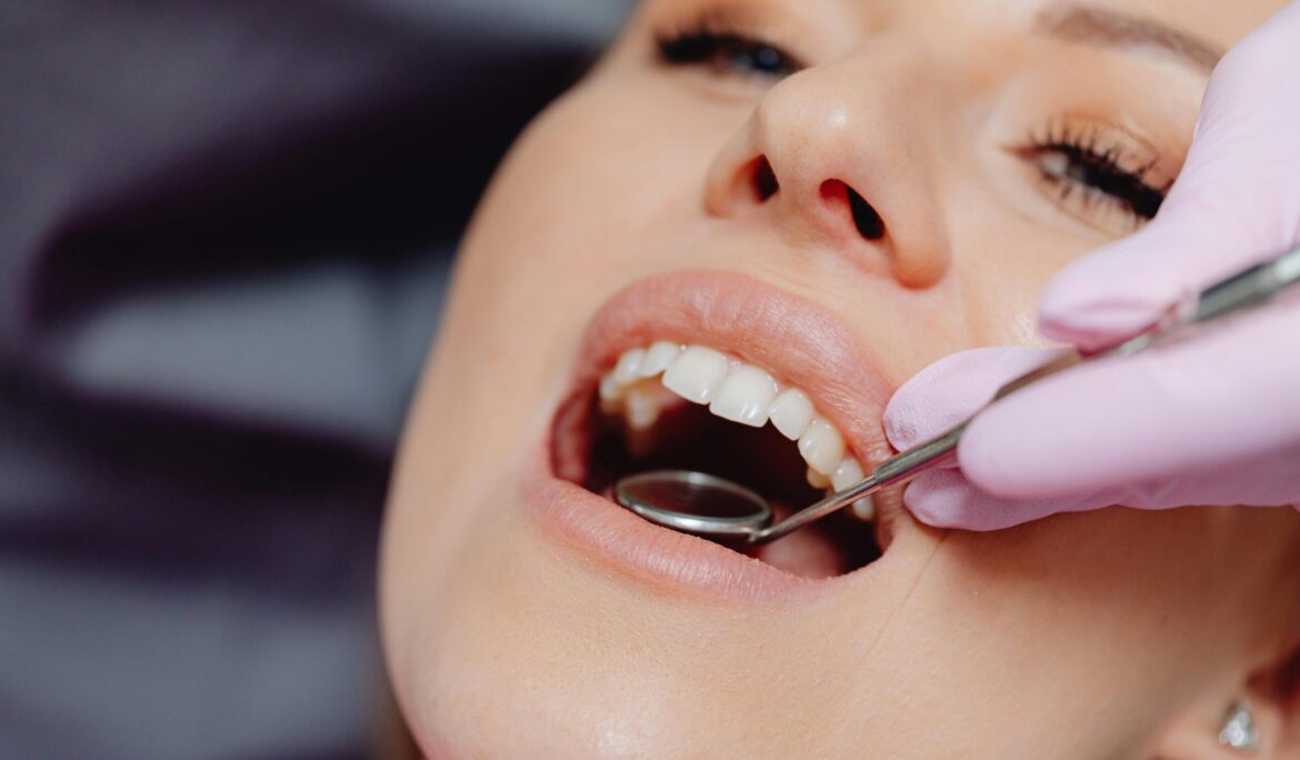 Benefits of Regular Dental Checkups