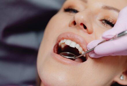 Benefits of Regular Dental Checkups