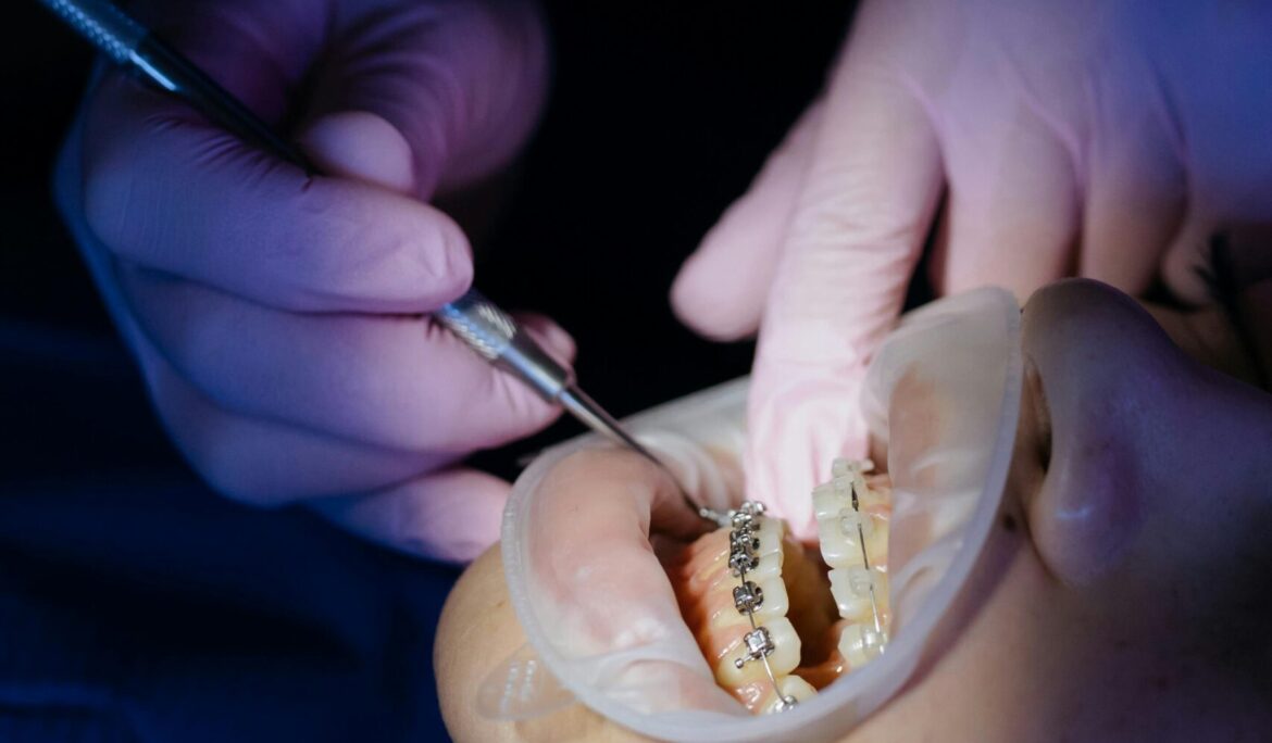 Is Teeth Straightening Painful? An Effective Guide by Universal Smiles Dental