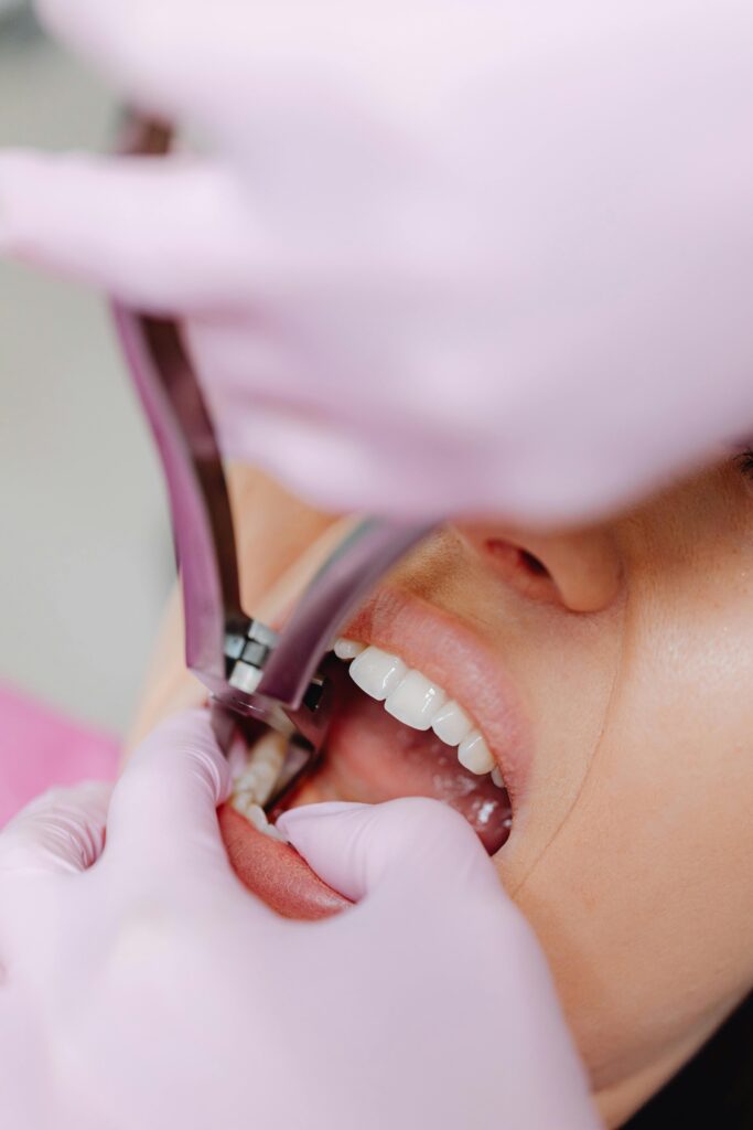How to prevent dental problems