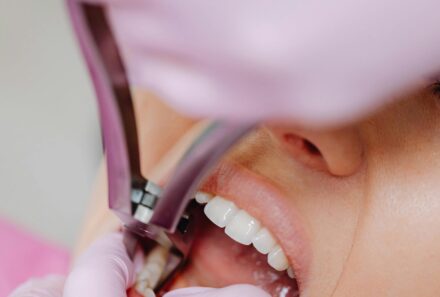 How to Prevent Dental Problems: Simple Habits for a Healthy Smile