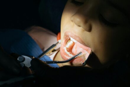 Preventing Dental Emergencies: Simple Steps to Protect Your Smile