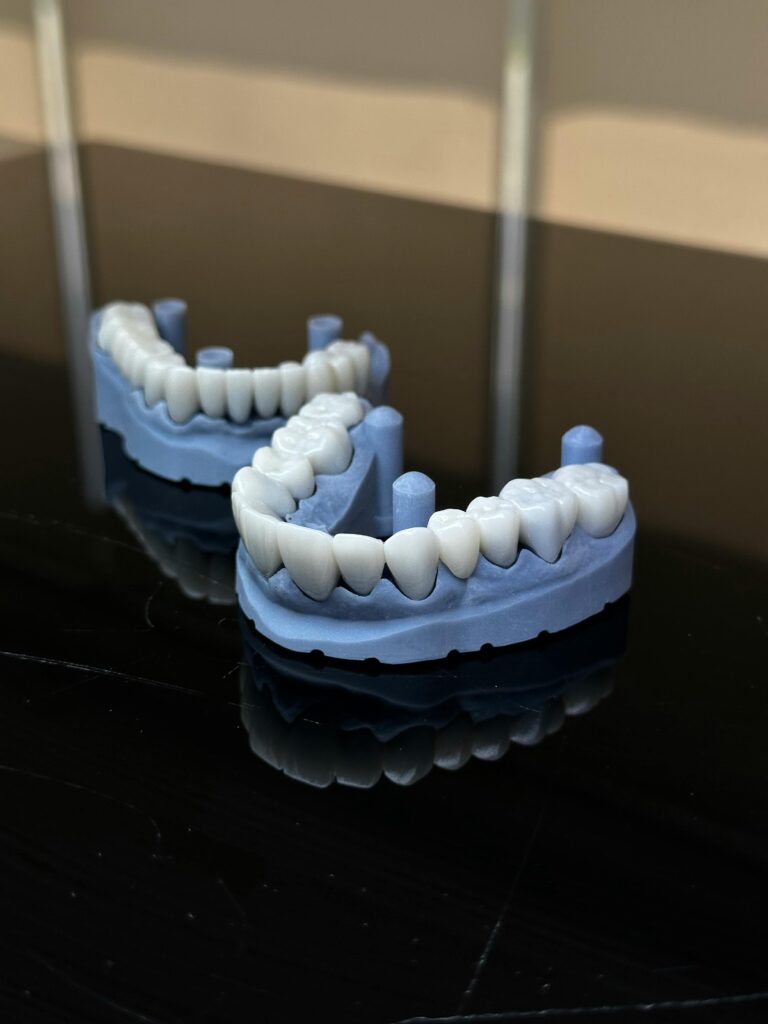 pain after dental crown and bridge treatment