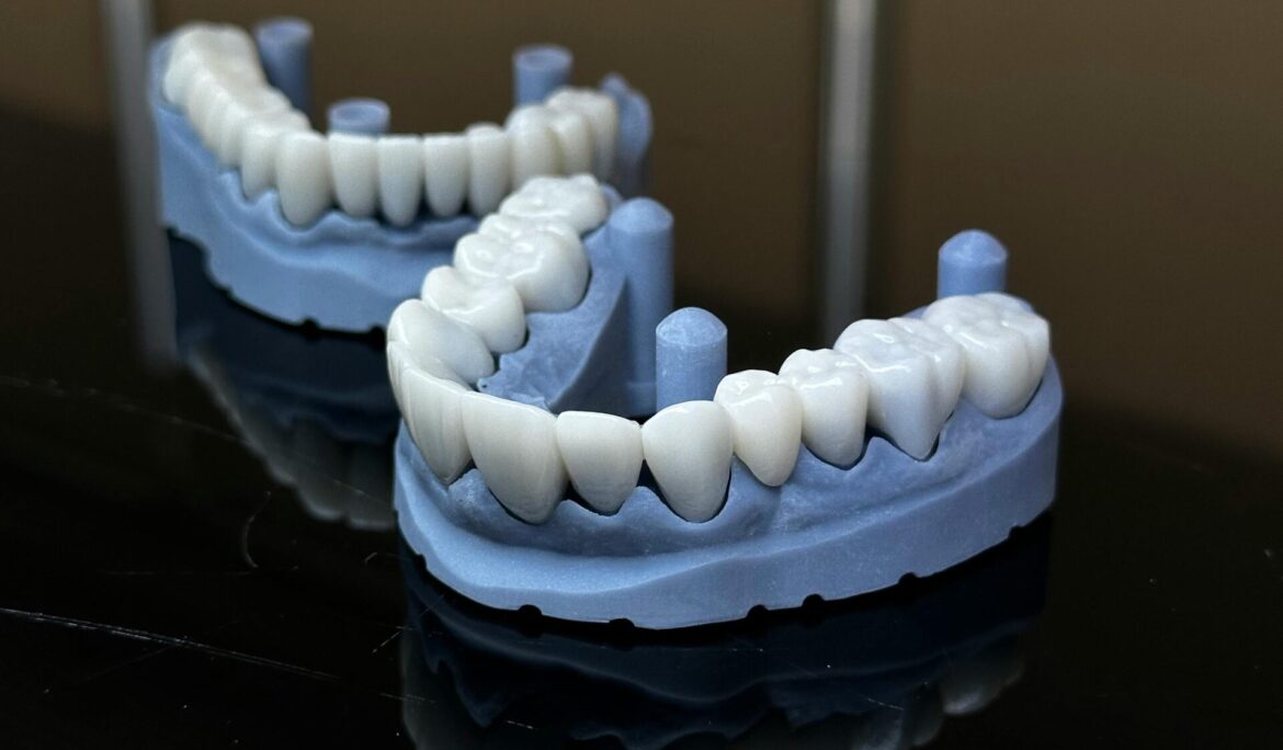 Pain After Dental Crown and Bridge Treatment: What to Expect and How to Manage It
