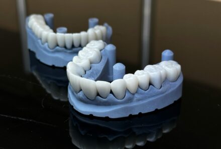 Pain After Dental Crown and Bridge Treatment: What to Expect and How to Manage It