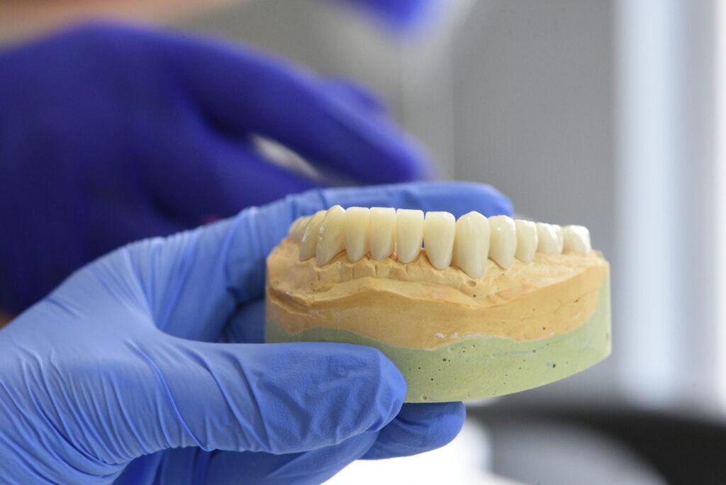 signs you need a dental crown