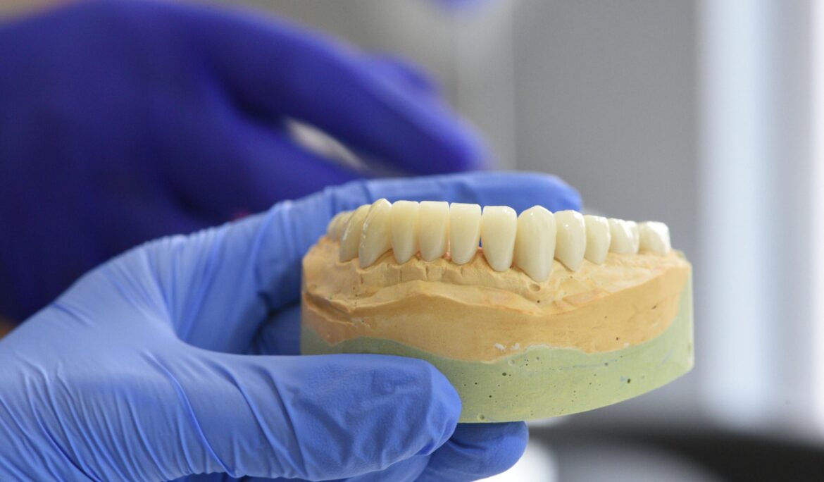 Signs You Need a Dental Crown: A Guide By Universal Smiles Dental