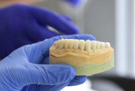 Signs You Need a Dental Crown: A Guide By Universal Smiles Dental