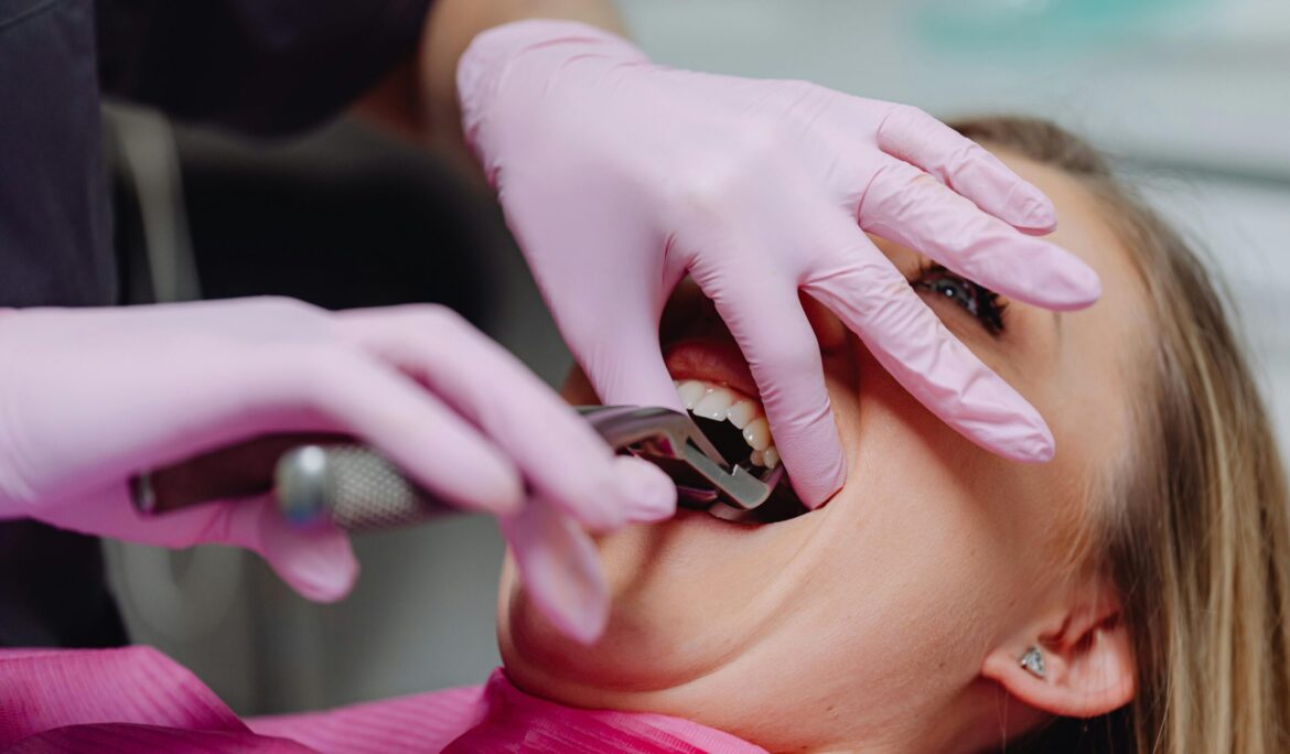 Things to Avoid After Tooth Extraction – Guide by Universal Smiles Dental