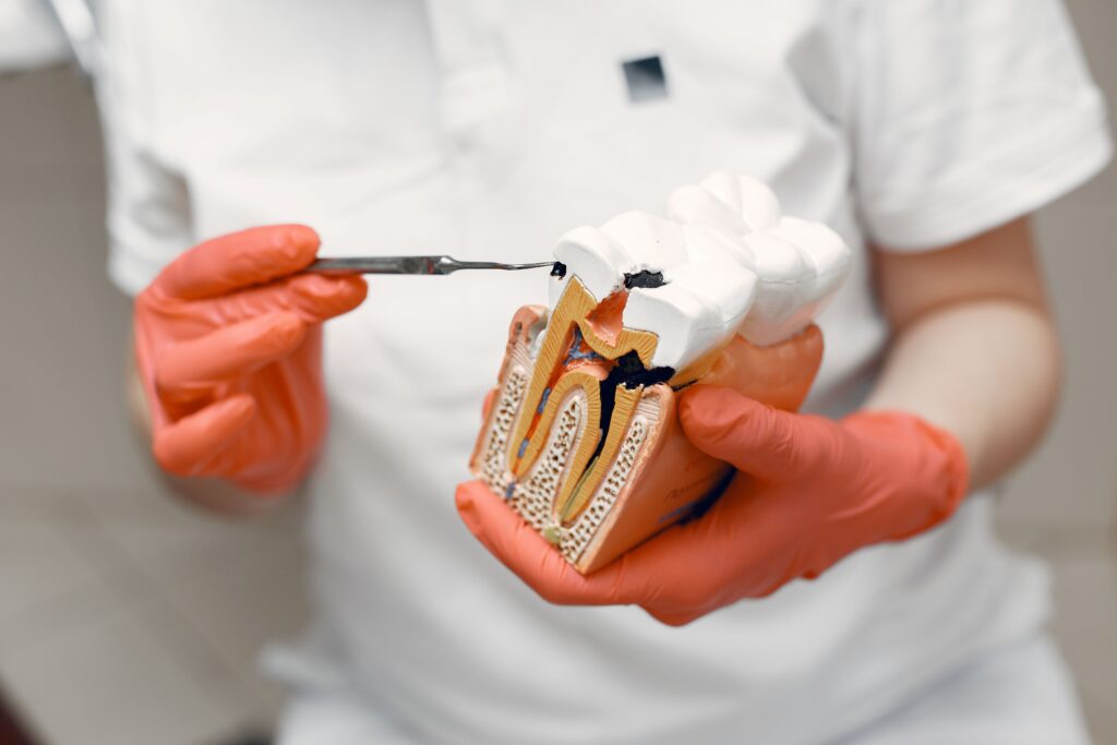 Tooth decay prevention