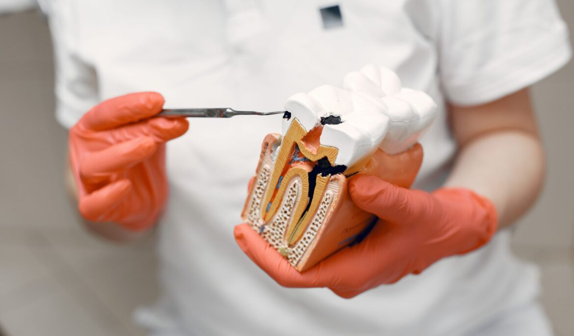 Tooth Decay Prevention: Simple Steps for a Healthy and Bright Smile