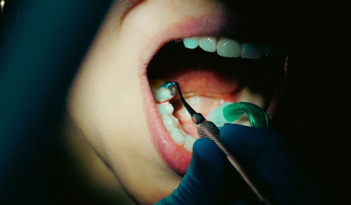 What Happens at a Dental Check Up? A Complete Guide For Your Visit