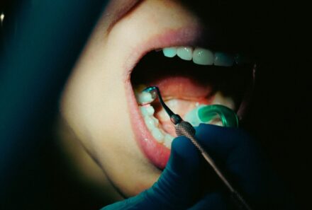 What Happens at a Dental Check Up? A Complete Guide For Your Visit