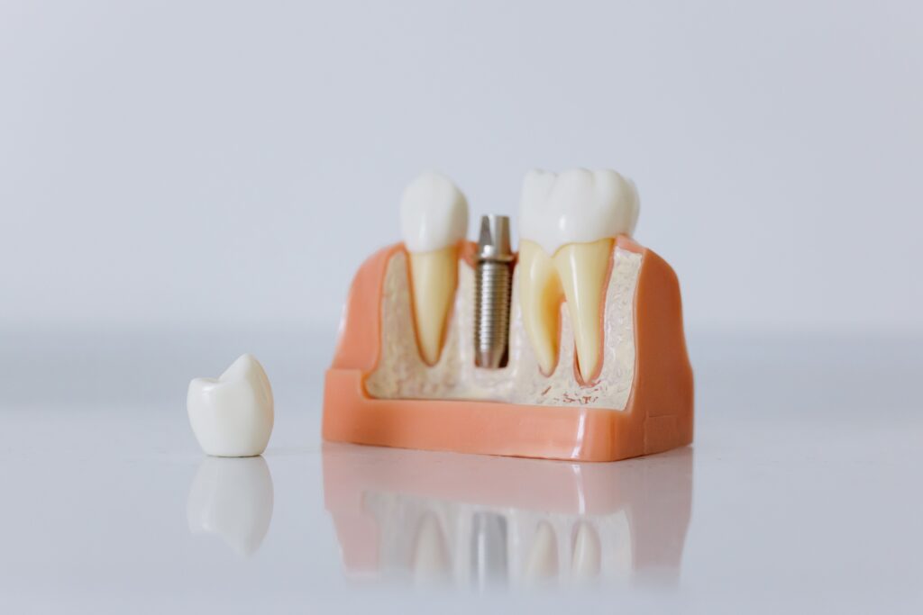 Dental care and implants